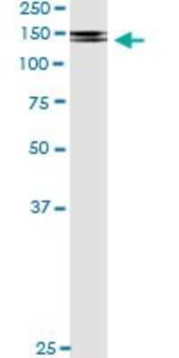 Immunoprecipitation: PDGF R beta Antibody (4C12) [H00005159-M08] - Analysis of PDGFRB transfected lysate using anti-PDGFRB monoclonal antibody and Protein A Magnetic Bead, and immunoblotted with PDGFRB rabbit polyclonal antibody.