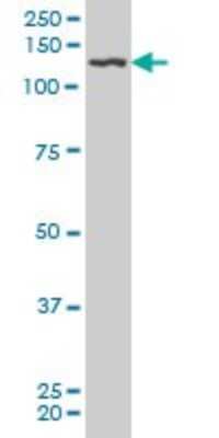 Western Blot: PDGF R beta Antibody (4C12) [H00005159-M08] - Analysis of PDGFRB expression in human stomach.
