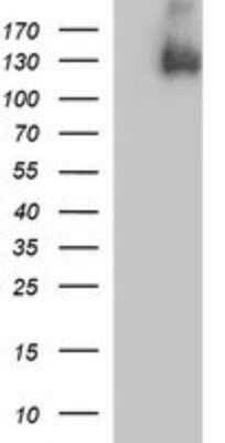 Western Blot: PDGF R beta Antibody (OTI1E8) - Azide and BSA Free [NBP2-73304] - Analysis of HEK293T cells were transfected with the pCMV6-ENTRY control (Left lane) or pCMV6-ENTRY PDGFRB .