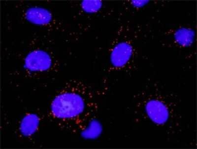 Proximity Ligation Assay: PDGF R beta Antibody [H00005159-D01P] - Analysis of protein-protein interactions between PDGFRB and PLCG1. Mahlavu cells were stained with anti-PDGFRB rabbit purified polyclonal 1:600 and anti-PLCG1 mouse monoclonal antibody 1:100. Each red dot represents the detection of protein-protein interaction complex, and nuclei were counterstained with DAPI (blue).