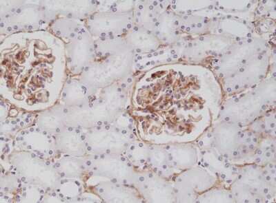 Immunohistochemistry-Paraffin: PDGF R beta Antibody (RM303) [NBP2-61578] - Immunohistochemical staining of formalin fixed and paraffin embedded human kidney tissue section using NBP2-61578.