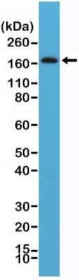 Western Blot: PDGF R beta Antibody (RM303) [NBP2-61578] - Western Blot of human brain tissue lysate using NBP2-61578.