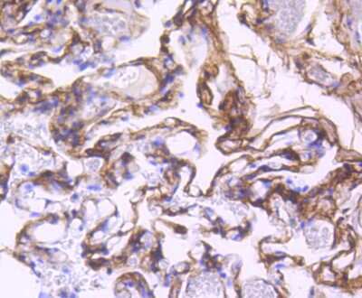 Immunohistochemistry-Paraffin: PDGF R beta Antibody (SY10-08) [NBP2-67384] - Analysis of paraffin-embedded human lung tissue using anti-PDGF Receptor beta antibody. Counter stained with hematoxylin.