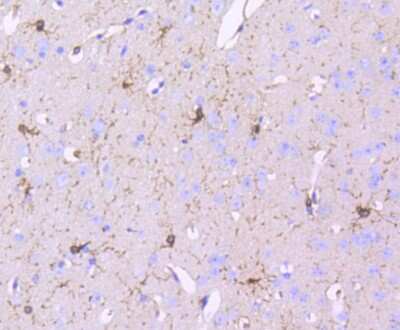 Immunohistochemistry-Paraffin: PDGF R beta Antibody (SY10-08) [NBP2-67384] - Analysis of paraffin-embedded mouse brain tissue using anti-PDGF Receptor beta antibody. Counter stained with hematoxylin.