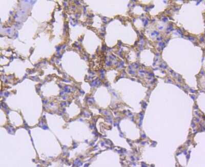 Immunohistochemistry-Paraffin: PDGF R beta Antibody (SY10-08) [NBP2-67384] - Analysis of paraffin-embedded mouse lung tissue using anti-PDGF Receptor beta antibody. Counter stained with hematoxylin.