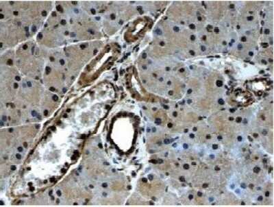 Immunohistochemistry-Paraffin: PDGF Receptor alpha Antibody (RM0004-3G28) [NB110-61020] - PDGFR-a immunohistochemistry staining of paraffin sections of mouse pancreas from LPS exposed animals.