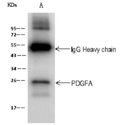 Immunoprecipitation: PDGFA Antibody [NBP2-99113] - PDGFA was immunoprecipitated using: Lane A: 0.5 mg Jurkat Whole Cell Lysate. 2 ul anti-PDGFA rabbit polyclonal antibody and 60 ug of Immunomagnetic beads. Protein A/G. Primary antibody: Anti-PDGFA rabbit polyclonal antibody, at 1:100 dilution. Secondary antibody: Goat Anti-Rabbit IgG (H+L)/HRP at 1/10000 dilution. Developed using the ECL technique. Performed under reducing conditions. Predicted band size: 24 kDa. Observed band size: 24 kDa