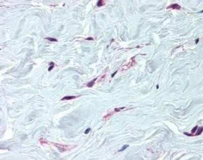 Immunohistochemistry-Paraffin: PDGFR alpha Antibody [NBP1-40031] - Staining of human breast, fibroblasts tissue after heat-induced antigen retrieval. Antibody concentration 5 ug/ml.