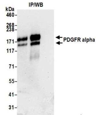 Immunoprecipitation: PDGFR alpha Antibody [NBP3-14686] - Whole cell lysate (1.0 mgper IP reaction; 20% of IP loaded) from NCI-H1703 cellsprepared using NETN lysis buffer. Antibodies: Rabbit antiPDGFR alpha recombinant monoclonal antibody used for IP at 20 ul/mg lysate. PDGFRalpha was also immunoprecipitated by rabbit anti-PDGFR alpha recombinant monoclonal antibody For blotting immunoprecipitated PDGFR alpha,was used at 1:1000. Chemiluminescence with an exposuretime of 30 seconds.