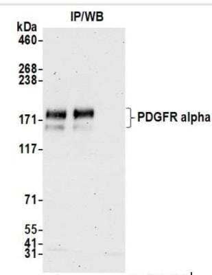 Immunoprecipitation: PDGFR alpha Antibody [NBP3-14711] - Samples: Whole cell lysate (1 mg forIP; 5% of IP loaded) from NCI-H1703 cells prepared usingNETN lysis buffer. Antibodies: Rabbit anti-PDGFR alpharecombinant monoclonal antibody used for IP at 20 ul/mg lysate. PDGFR alpha was alsoimmunoprecipitated by rabbit anti-PDGFR alpha antibody. For blotting immunoprecipitated PDGFRalpha, was used at 1:1000. Chemiluminescencewith an exposure time of 75 seconds.