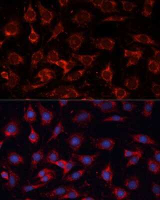 Immunocytochemistry/Immunofluorescence: PDHA2 Antibody [NBP2-94194] - Immunofluorescence analysis of C6 cells using PDHA2 Polyclonal Antibody (NBP2-94194) at dilution of 1:100 (40x lens). Blue: DAPI for nuclear staining.