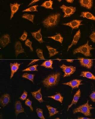 Immunocytochemistry/Immunofluorescence: PDHA2 Antibody [NBP2-95157] - Analysis of L929 cells using PDHA2 . Blue: DAPI for nuclear staining.