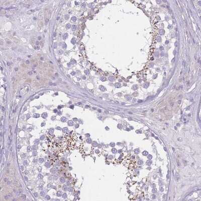 Immunohistochemistry: PDHA2 Antibody [NBP2-32054] - Staining of human testis shows moderate cytoplasmic positivity in subset of cells in seminiferus ducts.