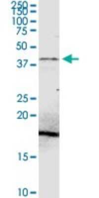 Western Blot: PDHA2 Antibody [H00005161-D01P] - Analysis of PDHA2 expression in A-431.