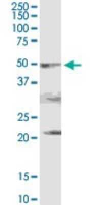 Western Blot: PDHA2 Antibody [H00005161-D01P] - Analysis of PDHA2 expression in mouse testis.
