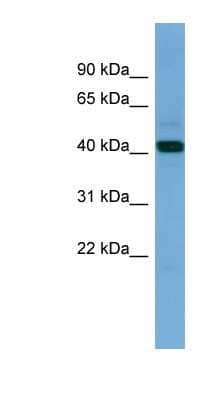 Western Blot: PDHA2 Antibody [NBP1-79536] - Human Placenta lysate, concentration 0.2-1 ug/ml.