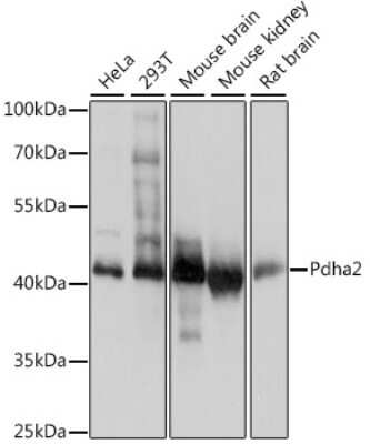 Western Blot: PDHA2 Antibody [NBP2-95157] - Analysis of extracts of various cell lines, using PDHA2 at 1:1000 dilution. Secondary antibody: HRP Goat Anti-Rabbit IgG (H+L) at 1:10000 dilution. Lysates/proteins: 25ug per lane. Blocking buffer: 3% nonfat dry milk in TBST. Detection: ECL Basic Kit . Exposure time: 1s.