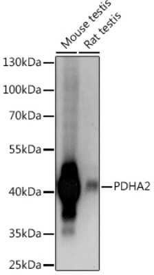 Western Blot: PDHA2 Antibody [NBP3-15503] - Western blot analysis of extracts of various cell lines, using PDHA2 Rabbit pAb (NBP3-15503) at 1:1000 dilution. Secondary antibody: HRP Goat Anti-Rabbit IgG (H+L) at 1:10000 dilution. Lysates/proteins: 25ug per lane. Blocking buffer: 3% nonfat dry milk in TBST. Detection: ECL Basic Kit. Exposure time: 1s.