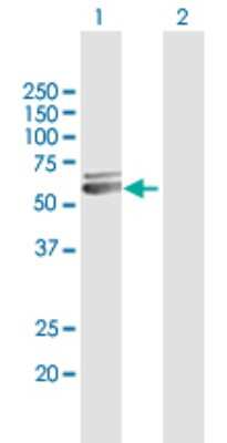 Western Blot: PDHX Antibody [H00008050-D01P] - Analysis of PDHX expression in transfected 293T cell line by PDHX polyclonal antibody.Lane 1: PDHX transfected lysate(54.10 KDa).Lane 2: Non-transfected lysate.