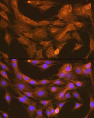 Immunocytochemistry/Immunofluorescence: PDIA6 Antibody (2Q1L1) [NBP3-16365] - Immunofluorescence analysis of C6 cells using PDIA6 Rabbit mAb (NBP3-16365) at dilution of 1:100 (40x lens). Blue: DAPI for nuclear staining.