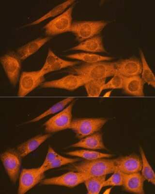 Immunocytochemistry/Immunofluorescence: PDIA6 Antibody (2Q1L1) [NBP3-16365] - Immunofluorescence analysis of NIH-3T3 cells using PDIA6 Rabbit mAb (NBP3-16365) at dilution of 1:100 (40x lens). Blue: DAPI for nuclear staining.