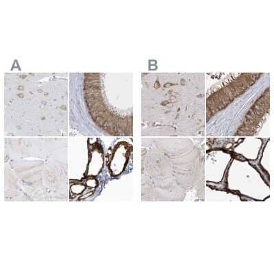 <b>Independent Antibodies Validation. </b>Immunohistochemistry-Paraffin: PDIA6 Antibody [NBP2-38213] - Staining of human cerebral cortex, epididymis, skeletal muscle and thyroid gland using Anti-PDIA6 antibody NBP2-38213 (A) shows similar protein distribution across tissues to independent antibody NBP1-84798 (B).