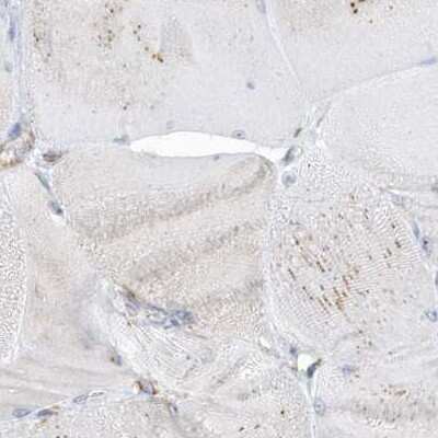 Immunohistochemistry-Paraffin: PDIA6 Antibody [NBP2-38213] - Staining of human skeletal muscle using Anti-PDIA6 antibody NBP2-38213.