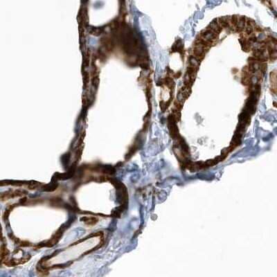 <b>Genetic Strategies Validation. </b>Immunohistochemistry-Paraffin: PDIA6 Antibody [NBP2-38213] - Staining of human thyroid gland using Anti-PDIA6 antibody NBP2-38213.