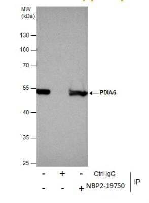 Immunoprecipitation: PDIA6 Antibody [NBP2-19750] - Immunoprecipitation of PDIA6 protein from 293T whole cell extracts using 5 ug of PDIA6 antibody [N1N3] . Western blot analysis was performed using PDIA6 antibody [N1N3]. EasyBlot anti-Rabbit IgG was used as a secondary reagent.