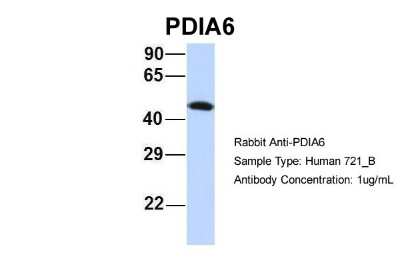 Western Blot: PDIA6 Antibody [NBP1-57968] - Analysis of 721_B cell lysate. Antibody Dilution: 1.0 ug/ml PDIA6 is strongly supported by BioGPS gene expression data to be expressed in Human 721_B cells.