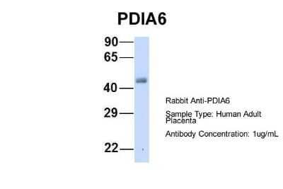 Western Blot: PDIA6 Antibody [NBP1-57968] - Human Adult Placenta, Antibody Dilution: 1.0 ug/ml.