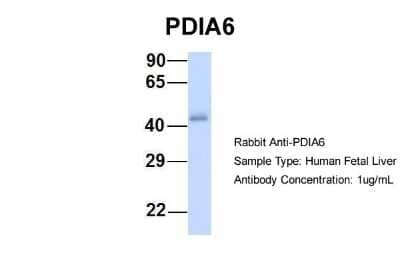 Western Blot: PDIA6 Antibody [NBP1-57968] - Human Fetal Liver, Antibody Dilution: 1.0 ug/ml.