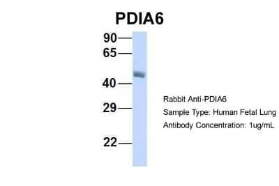 Western Blot: PDIA6 Antibody [NBP1-57968] - Human Fetal Lung, Antibody Dilution: 1.0 ug/ml.