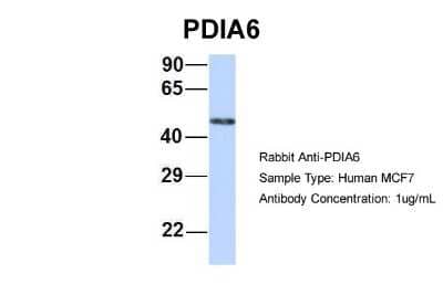 Western Blot: PDIA6 Antibody [NBP1-57968] - MCF7, Antibody Dilution: 1.0 ug/ml PDIA6 is strongly supported by BioGPS gene expression data to be expressed in MCF7.