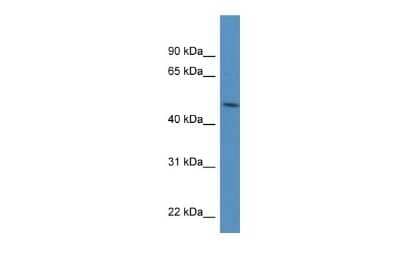 Western Blot: PDIA6 Antibody [NBP1-57999] - Antibody  Titration: 0.2-1 ug/ml ELISA Titer: 1 : 62500 Positive control: 721_B cell lysate PDIA6 is strongly supported by BioGPS gene expression data to be expressed in Human 721_B cells.