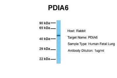 Western Blot: PDIA6 Antibody [NBP1-57999] - Sample Tissue: Human Fetal Lung Antibody Dilution: 1.0 ug/ml