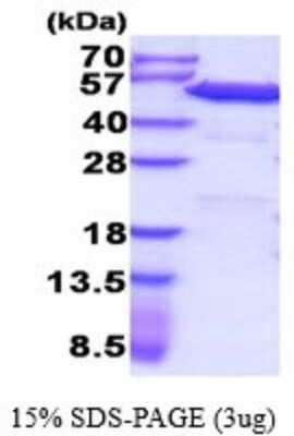 SDS-Page: Recombinant Human PDIA6 Protein [NBP2-52142] - 15% SDS Page (3 ug)