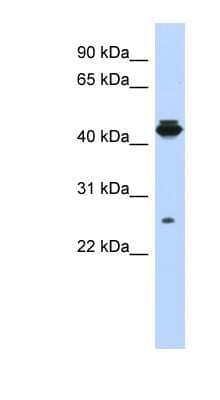 Western Blot: PDIK1L Antibody [NBP1-56732] - MCF-7 whole cell lysates, concentration 0.2-1 ug/ml.