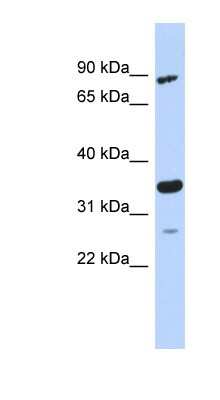 Western Blot: PDIK1L Antibody [NBP1-56733] - MCF-7 whole cell lysates, concentration 0.2-1 ug/ml.