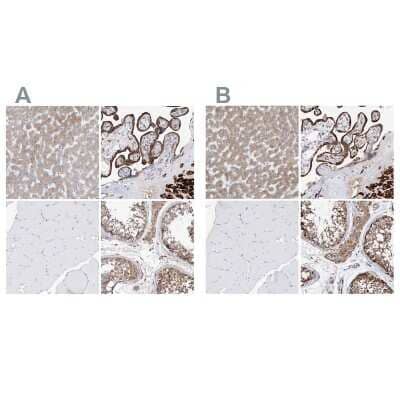 <b>Independent Antibodies Validation and Orthogonal Strategies Validation.</b>Immunohistochemistry-Paraffin: PDIR Antibody [NBP1-92250] - Staining of human liver, placenta, skeletal muscle and testis using Anti-PDIA5 antibody NBP1-92250 (A) shows similar protein distribution across tissues to independent antibody NBP1-92252 (B).