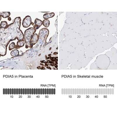 Immunohistochemistry-Paraffin: PDIR Antibody [NBP1-92250] - Analysis in human placenta and skeletal muscle tissues using NBP1-92250 antibody. Corresponding PDIA5 RNA-seq data are presented for the same tissues.