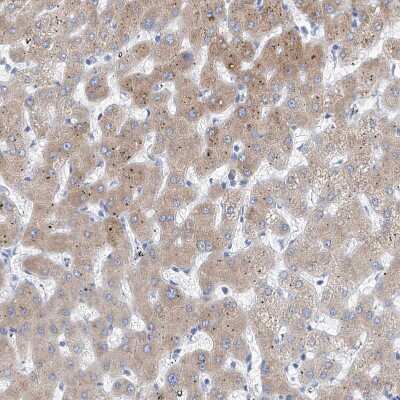 Immunohistochemistry-Paraffin: PDIR Antibody [NBP1-92250] - Staining of human liver shows moderate granular cytoplasmic positivity in hepatocytes.