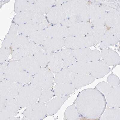 Immunohistochemistry-Paraffin: PDIR Antibody [NBP1-92250] - Staining of human skeletal muscle shows no positivity in myocytes as expected.