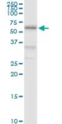 Western Blot: PDIR Antibody [H00010954-D01P] - Analysis of PDIA5 expression in HeLa.