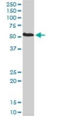 Western Blot: PDIR Antibody [H00010954-D01P] - Analysis of PDIA5 expression in human pancreas.