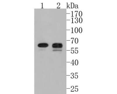 Western Blot: PDK-1 Antibody (SD204-9) [NBP2-67755] - Western blot analysis of PDK-1 on different lysates. Proteins were transferred to a PVDF membrane and blocked with 5% BSA in PBS for 1 hour at room temperature. The primary antibody (1/500) was used in 5% BSA at room temperature for 2 hours. Goat Anti-Rab