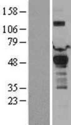 Western Blot: PDK1 Overexpression Lysate (Adult Normal) [NBL1-14249] Left-Empty vector transfected control cell lysate (HEK293 cell lysate); Right -Over-expression Lysate for PDK1.