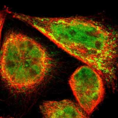 Immunocytochemistry/ Immunofluorescence PDK2 Antibody