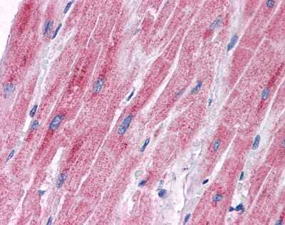 Immunohistochemistry-Paraffin: PDK2 Antibody [NBP1-54699] - Human Heart Tissue, antibody concentration 5 ug/ml.