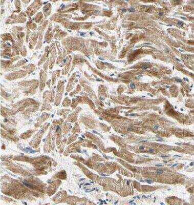 Immunohistochemistry-Paraffin PDK2 Antibody